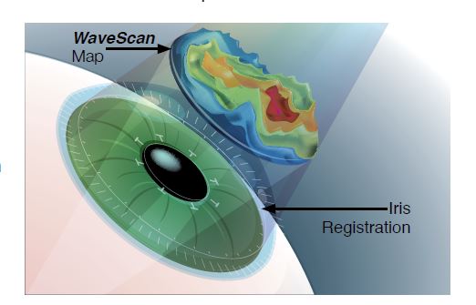 Creating Eye Map for LASIK